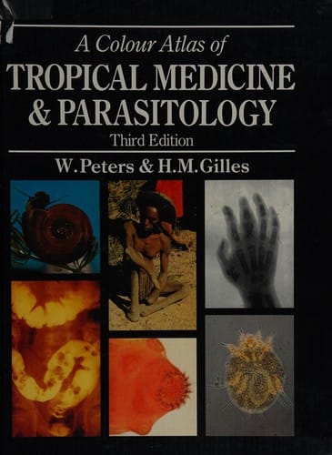 Color Atlas of Tropical Medicine and Parasitology A