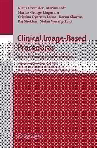 Clinical Image-Based Procedures. From Planning to Intervention: International Workshop, CLIP 2012, Held in Conjunction with MICCAI 2012, Nice, France, ...