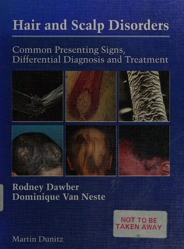 Hair and scalp disorders: common presenting signs, differential diagnosis, and treatment