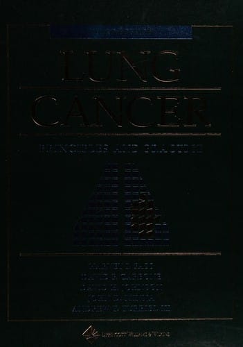 Lung cancer: principles and practice