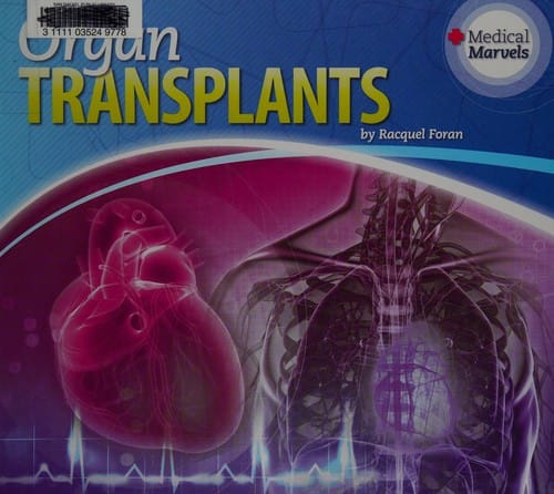 Organ transplants