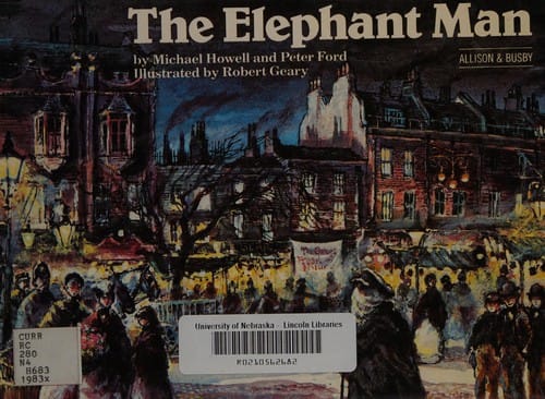 The elephant man