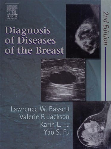 Diagnosis of diseases of the breast