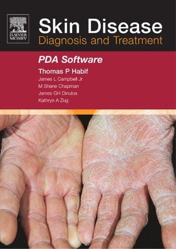 Skin Disease CD-ROM PDA Software: Diagnosis and Treatment