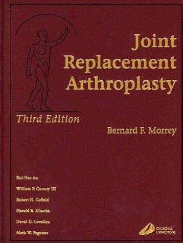 Joint Replacement Arthroplasty