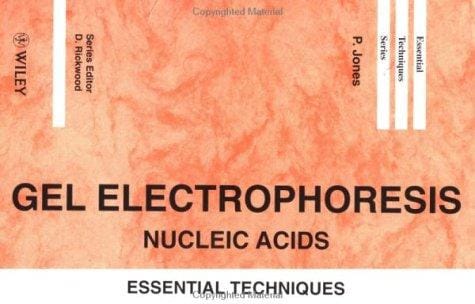 Gel Electrophoresis: Nucleic Acids: Essential Techniques