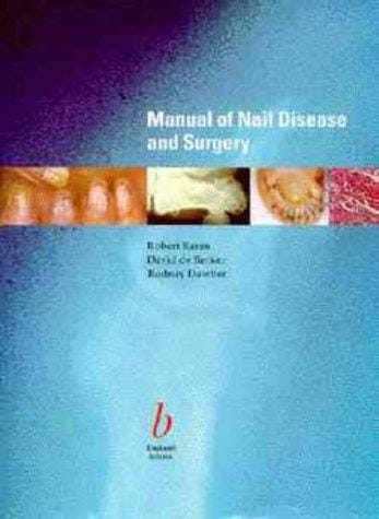 Diseases of the nails and their management