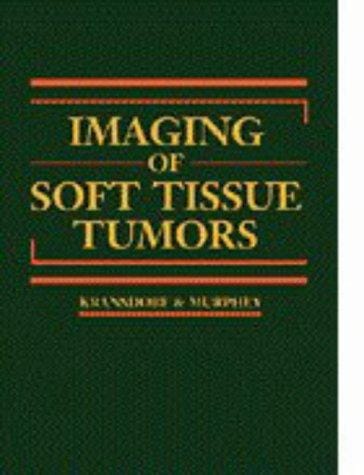 Imaging of soft tissue tumors