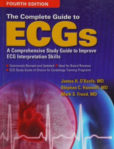 Complete Guide to ECGs