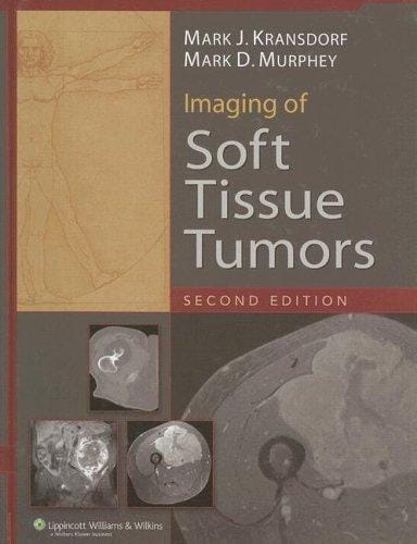 Imaging of soft tissue tumors