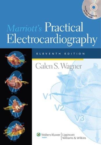 Marriott's Practical Electrocardiography (Marriott's Practical Electrocardiography (Wagner))