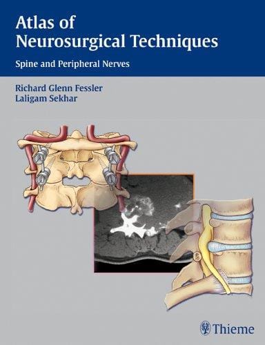 Atlas of Neurosurgical Techniques: Spine