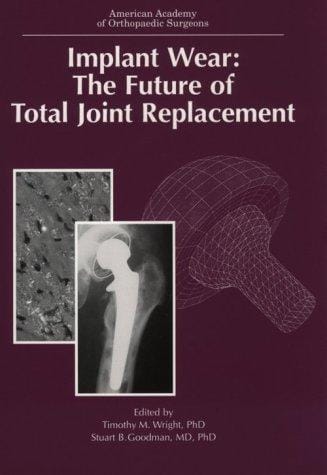 Implant wear: the future of total joint replacement : symposium, Oakbrook, Illinois, September 1995