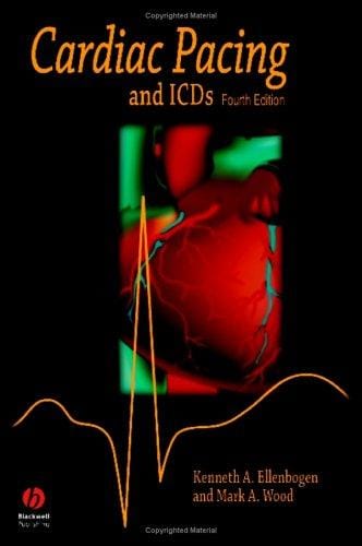Cardiac Pacing and ICDS (4th Edition)