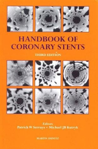 Handbook of Coronary Stents