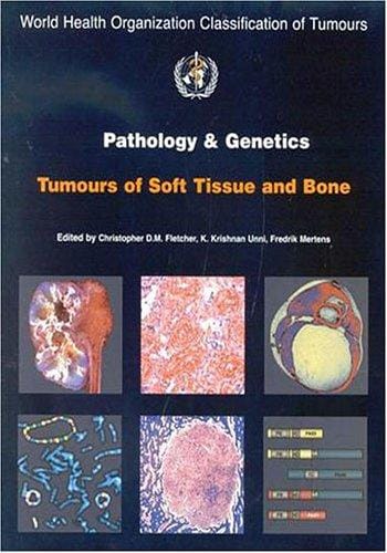 Pathology And Genetics of Tumours of the Soft Tissues And Bones: World Health Organization Classification of Tumours