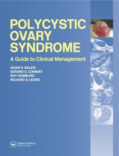 Polycystic Ovary Syndrome: A Guide to Clinical Management