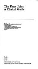 nee joint: a clinical guide