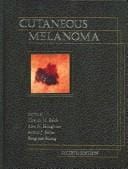 Cutaneous Melanoma