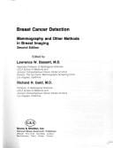 Breast Cancer Detection: Mammography and Other Methods in Breast Imaging