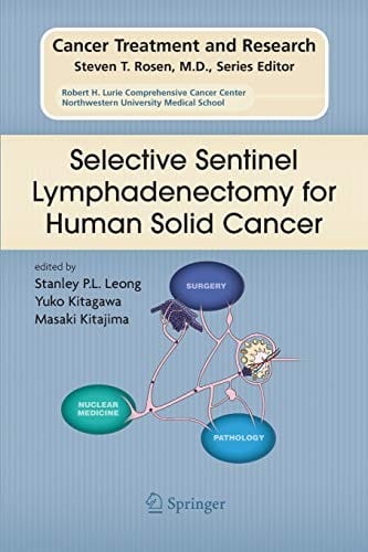 Selective Sentinel Lymphadenectomy for Human Solid Cancer