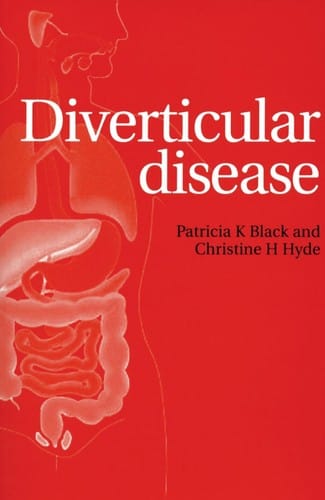 Diverticular disease