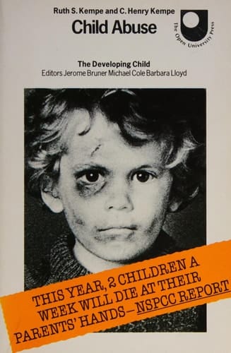 Child Abuse (Developing Child)