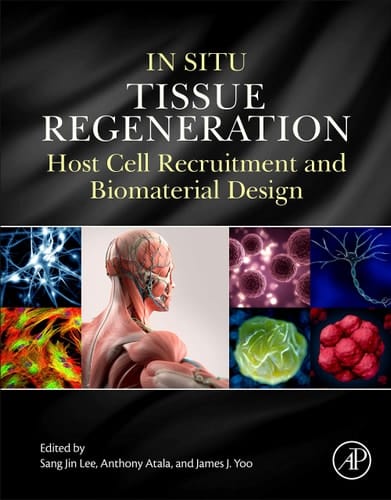 In Situ Tissue Regeneration Host Cell Recruitment and Biomaterial Design