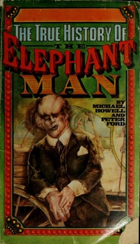 The True History of the Elephant Man