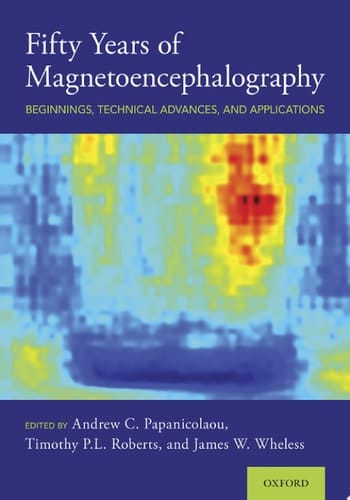 Fifty Years Of Magnetoencephalography: Beginnings, Technical Advances, And Applications