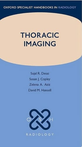 Thoracic Imaging (Oxford Specialist Handbooks in Radiology)