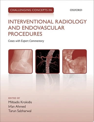 Challenging Concepts in Interventional Radiology (Challenging Cases)