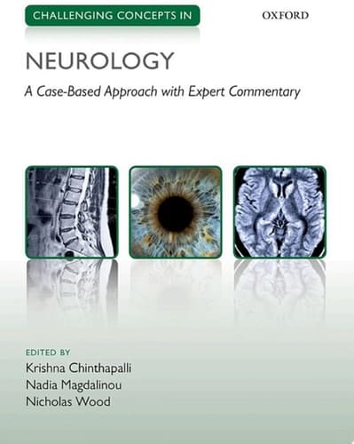 Challenging Concepts in Neurology: Cases with Expert Commentary (Challenging Cases)