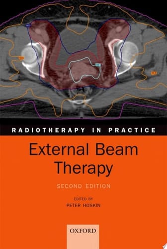 External Beam Therapy