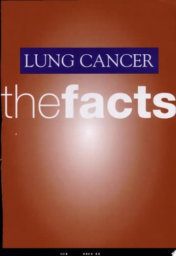 Lung Cancer: The Facts (The Facts Series)