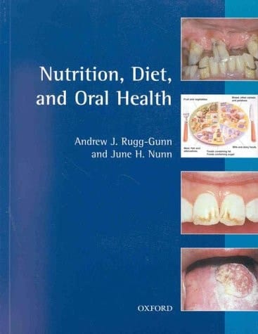 Nutrition, Diet, and Oral Health (Oxford Medical Publications)