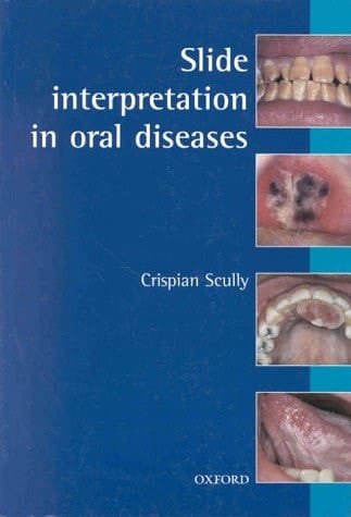 Slide Interpretation in Oral Diseases (Oxford Medical Publications)