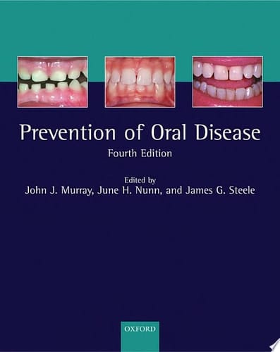 Prevention of Oral Disease