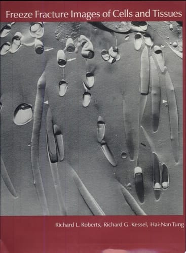 Freeze Fracture Images of Cells and Tissues