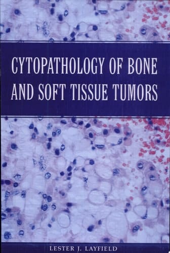 Cytopathology of Bone and Soft Tissue Tumors