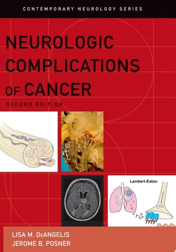 Neurologic Complications of Cancer (Contemporary Neurology Series, 73)