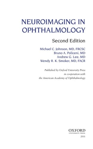 Neuroimaging in Ophthalmology (American Academy of Ophthalmology Monograph Series)