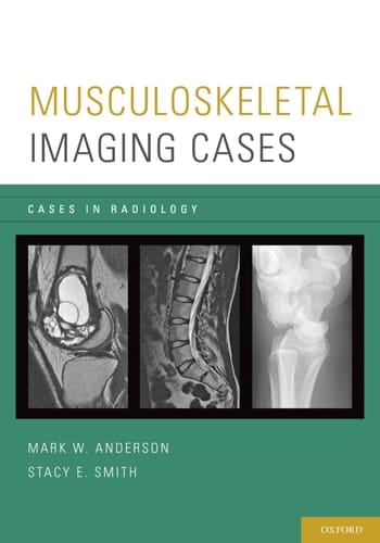 Musculoskeletal Imaging Cases (Cases in Radiology)