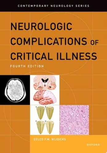 Neurologic Complications of Critical Illness (CONTEMPORARY NEUROLOGY SERIES)