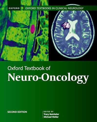 Oxford Textbook of Neuro-Oncology (Oxford Textbooks in Clinical Neurology)