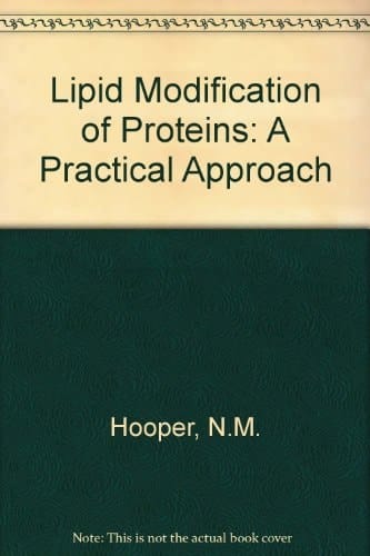 Lipid Modification of Proteins: A Practical Approach