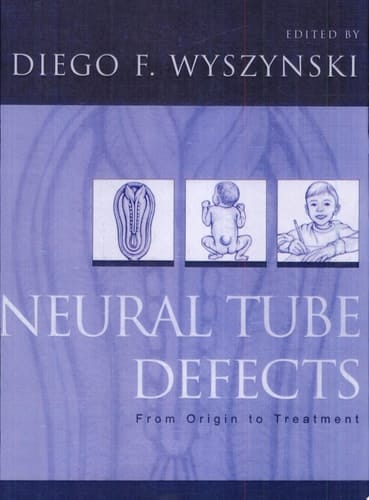 Neural Tube Defects