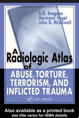 Radiologic Atlas of Abuse, Torture, Terrorism, and Inflicted Trauma