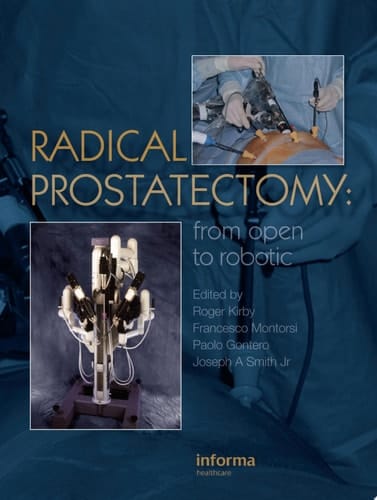Radical Prostatectomy: From Open to Robotic