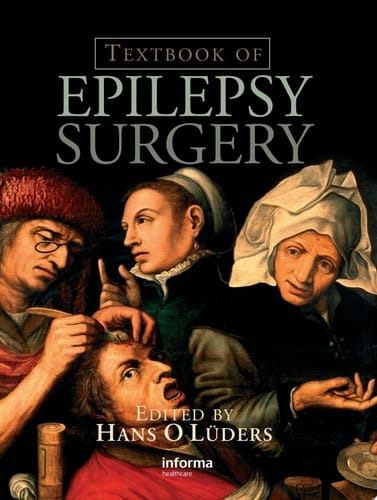 Textbook of Epilepsy Surgery